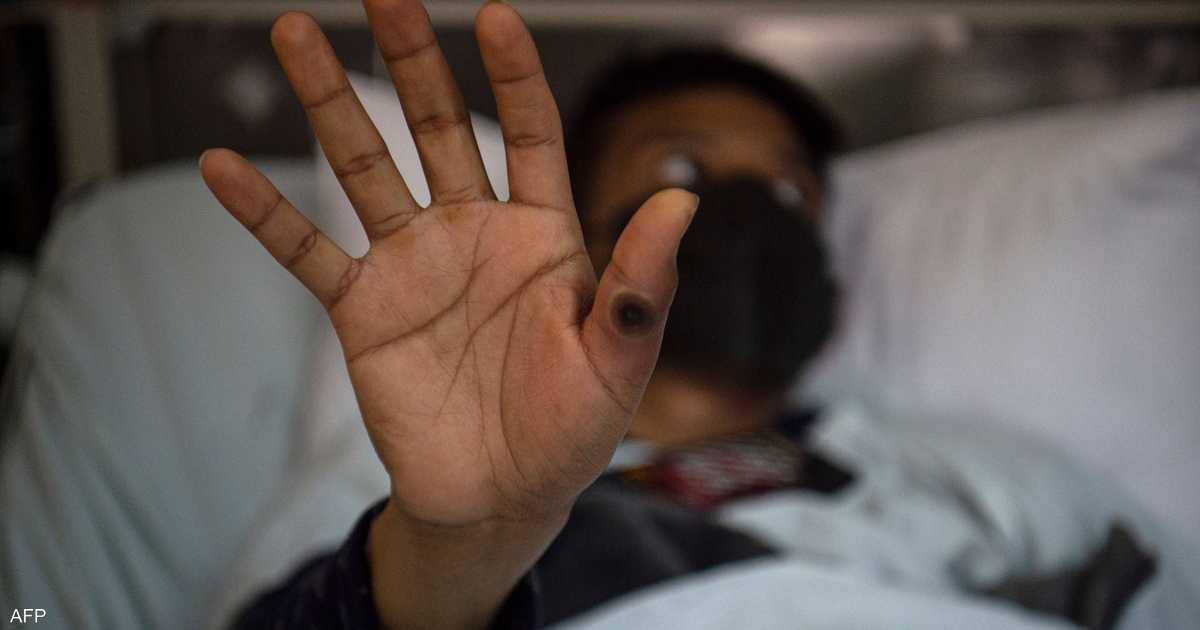 An important decision of the World Health Organization regarding monkeypox