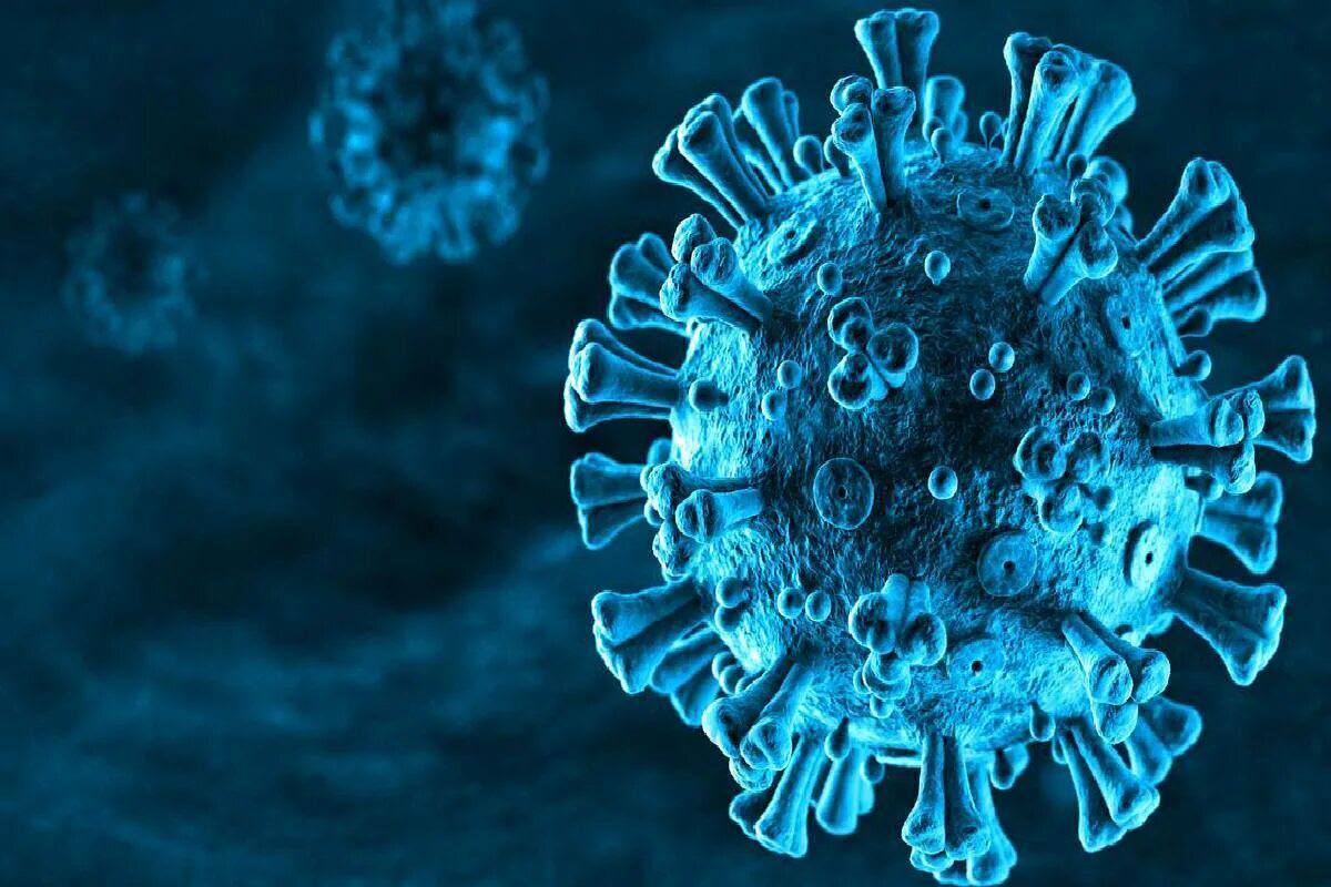 86 cases of COVID-19 infection recorded in Ivanovo region