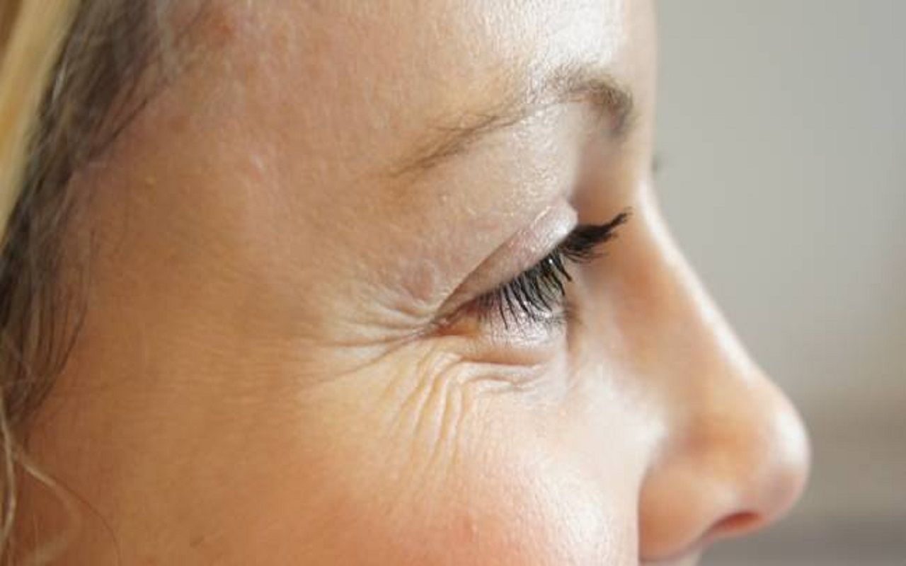 Beauty Tips: Wrinkles have started appearing on your face at an early age, so this could be the reason