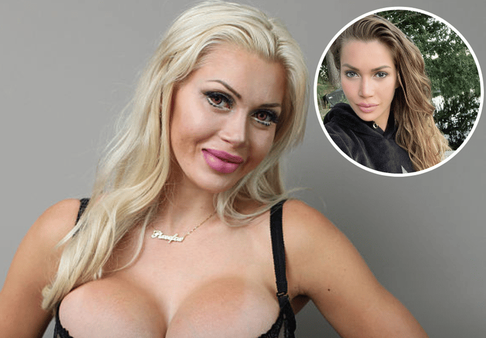 Plastic surgery earned him fame and the nickname "living cartoon" - Completely transformed after an operation that almost cost him his life