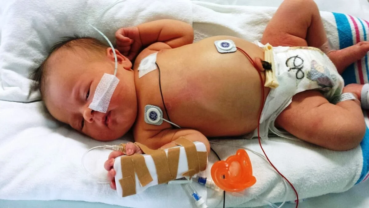 Covid-19 in children: diarrhea and vomiting could be the main symptoms