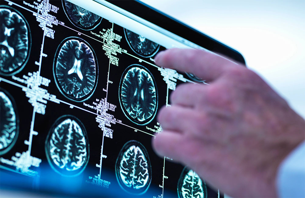 AI could be 'ultimate second opinion' on health issues